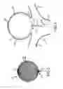 Fig. 03 - Electrolytic detachment elements for implant delivery systems