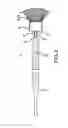 Fig. 04 - Electrolytic detachment elements for implant delivery systems