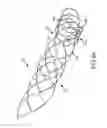 Fig. 08 - Wing bifurcation reconstruction device