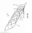 Fig. 09 - Wing bifurcation reconstruction device