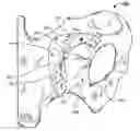 Fig. 01 - PATIENT SPECIFIC INSTRUMENTS