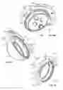 Fig. 05 - PATIENT SPECIFIC INSTRUMENTS
