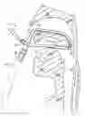Fig. 01 - Retractor suction catheter