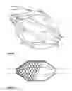 Fig. 06 - Device suitable for removing matter from inside the lumen and the wall of a body lumen