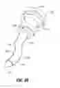 Fig. 04 - Flexible access assembly