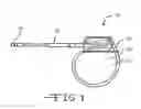 Fig. 02 - Tunneling tool for deliberate placement of an ILR