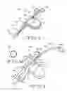 Fig. 03 - Tunneling tool for deliberate placement of an ILR