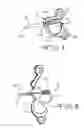 Fig. 05 - Tunneling tool for deliberate placement of an ILR