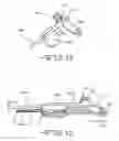 Fig. 07 - Tunneling tool for deliberate placement of an ILR