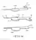 Fig. 08 - Tunneling tool for deliberate placement of an ILR
