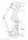 Fig. 08 - External fixation system with radio frequency shielding