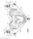 Fig. 09 - External fixation system with radio frequency shielding