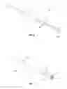 Fig. 06 - Growing spinal rod system