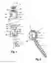Fig. 02 - Polyaxial bone anchoring device