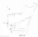 Fig. 02 - Mandibular bone plate