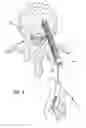 Fig. 04 - Pedicle screw with electro-conductive coating or portion