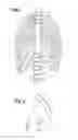 Fig. 02 - IMPLANT AND SYSTEM FOR BONE REPAIR