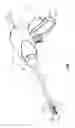 Fig. 02 - Apparatus for performing an electrosurgical procedure