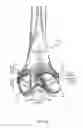 Fig. 04 - Method for creating a customized arthroplasty resection guide utilizing two-dimensional imaging