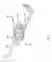 Fig. 07 - Method for creating a customized arthroplasty resection guide utilizing two-dimensional imaging