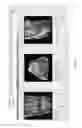Fig. 09 - Method for creating a customized arthroplasty resection guide utilizing two-dimensional imaging