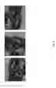 Fig. 14 - Method for creating a customized arthroplasty resection guide utilizing two-dimensional imaging