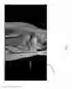 Fig. 21 - Method for creating a customized arthroplasty resection guide utilizing two-dimensional imaging