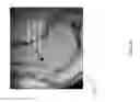 Fig. 27 - Method for creating a customized arthroplasty resection guide utilizing two-dimensional imaging