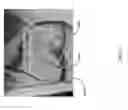 Fig. 31 - Method for creating a customized arthroplasty resection guide utilizing two-dimensional imaging