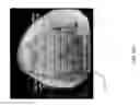 Fig. 33 - Method for creating a customized arthroplasty resection guide utilizing two-dimensional imaging