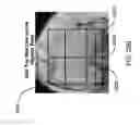 Fig. 34 - Method for creating a customized arthroplasty resection guide utilizing two-dimensional imaging
