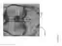 Fig. 37 - Method for creating a customized arthroplasty resection guide utilizing two-dimensional imaging