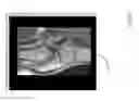 Fig. 38 - Method for creating a customized arthroplasty resection guide utilizing two-dimensional imaging