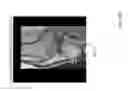 Fig. 40 - Method for creating a customized arthroplasty resection guide utilizing two-dimensional imaging