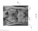 Fig. 42 - Method for creating a customized arthroplasty resection guide utilizing two-dimensional imaging