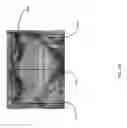 Fig. 44 - Method for creating a customized arthroplasty resection guide utilizing two-dimensional imaging