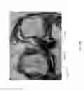 Fig. 51 - Method for creating a customized arthroplasty resection guide utilizing two-dimensional imaging