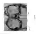 Fig. 52 - Method for creating a customized arthroplasty resection guide utilizing two-dimensional imaging