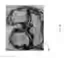 Fig. 53 - Method for creating a customized arthroplasty resection guide utilizing two-dimensional imaging