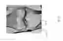Fig. 54 - Method for creating a customized arthroplasty resection guide utilizing two-dimensional imaging