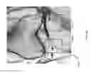 Fig. 55 - Method for creating a customized arthroplasty resection guide utilizing two-dimensional imaging