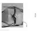 Fig. 58 - Method for creating a customized arthroplasty resection guide utilizing two-dimensional imaging