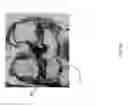 Fig. 61 - Method for creating a customized arthroplasty resection guide utilizing two-dimensional imaging