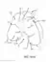 Fig. 64 - Method for creating a customized arthroplasty resection guide utilizing two-dimensional imaging