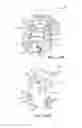 Fig. 66 - Method for creating a customized arthroplasty resection guide utilizing two-dimensional imaging
