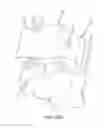 Fig. 67 - Method for creating a customized arthroplasty resection guide utilizing two-dimensional imaging