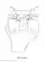 Fig. 69 - Method for creating a customized arthroplasty resection guide utilizing two-dimensional imaging
