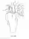 Fig. 71 - Method for creating a customized arthroplasty resection guide utilizing two-dimensional imaging