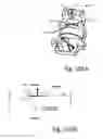 Fig. 73 - Method for creating a customized arthroplasty resection guide utilizing two-dimensional imaging