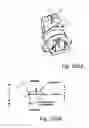 Fig. 74 - Method for creating a customized arthroplasty resection guide utilizing two-dimensional imaging